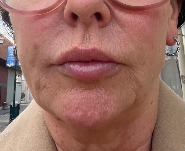 Before and After Image 1