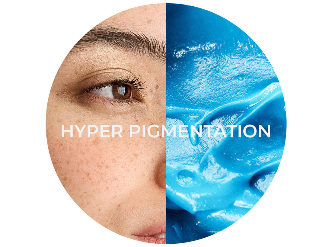 Blue Vision Lab brightening guide for hyperpigmentation and redness
